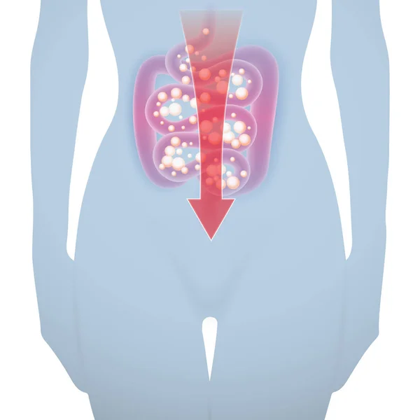 Silueta de mujer con intestino enfermo — Vector de stock