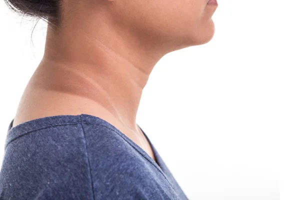 Close up skin of woman neck showing different color from sun UV — Stock Photo, Image