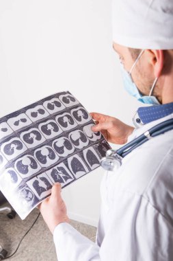 Doktor, göğüs ve karın boşluğunun tomografisini inceler ve inceler. Pulmonolojide hastalıkların teşhisi, akciğer patolojisi, bronşların iltihaplı hastalıkları, tüberküloz konulu konsept fotoğraf