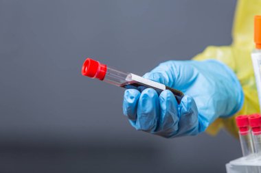 Eldiven giymiş, üzerinde kan örneği olan cam tüp. Coronavirus salgını. Salgın virüsü solunum sendromu