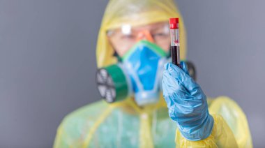 Laboratuvarda çalışan bilim adamı. Koruyucu giysiler, maske, gözlük ve kan örneği içeren eldivenler. Coronavirus salgını. Salgın virüsü solunum sendromu