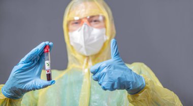 Laboratuvarda çalışan bilim adamı. Koruyucu giysiler, maske, gözlük ve kan örneği içeren eldivenler. Coronavirus salgını. Salgın virüsü solunum sendromu. - Zafer. başparmaklar yukarı
