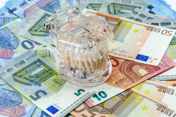 Kaken Model Met Tanden Tandheelkunde Een Stapel Eurobiljetten Symbool Van — Stockfoto