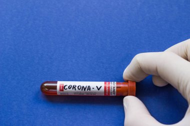 Çin 'deki virüs tacını incelemek için kanla dolu bir hastanenin test tüpü.
