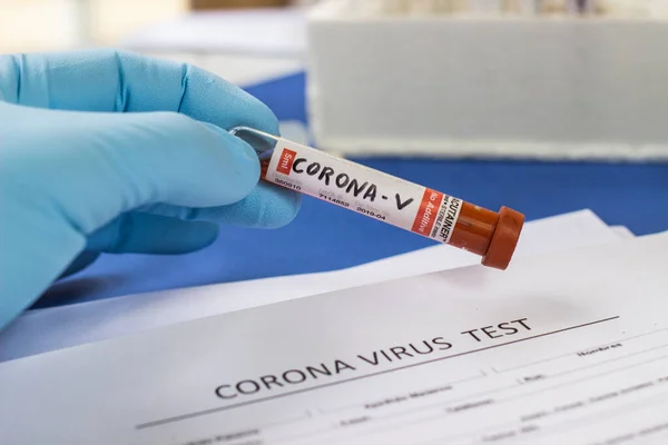 test tube of a hospital with blood to examine the virus crown in China