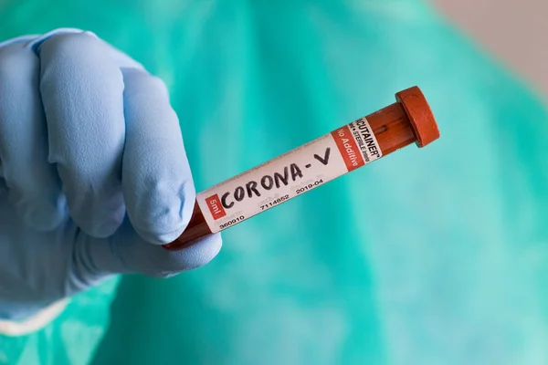 Doktor, hastanede korona virüsünü incelemek için üzerinde kan olan bir test tüpü tutuyor.