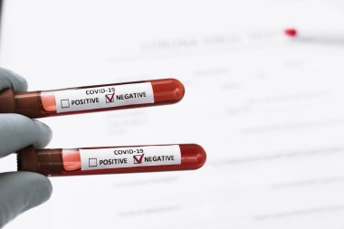 Çin 'deki virüs tacını incelemek için kanla dolu bir hastanenin test tüpü.