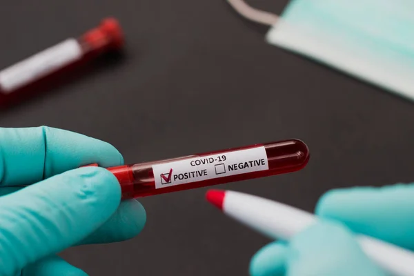 test tube of a hospital with blood to examine the virus crown in China