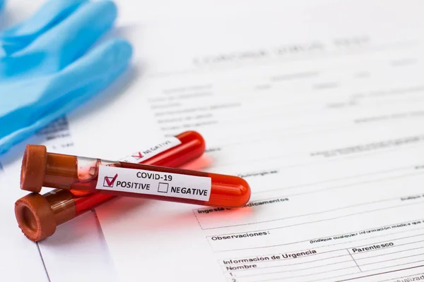 test tube of a hospital with blood to examine the virus crown in China