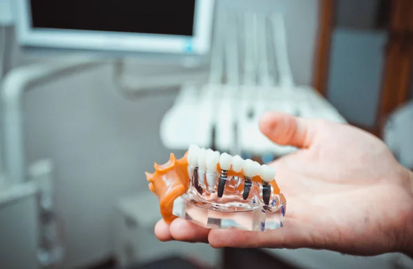 Diş hekimi gösteren diş plastik model vidalı implant öğretim, öğrenme ve hastalarda diş office bulanık arka plan ile