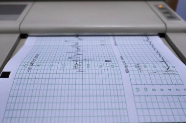 cardiotocography (ctg) doğum öncesi muayene
