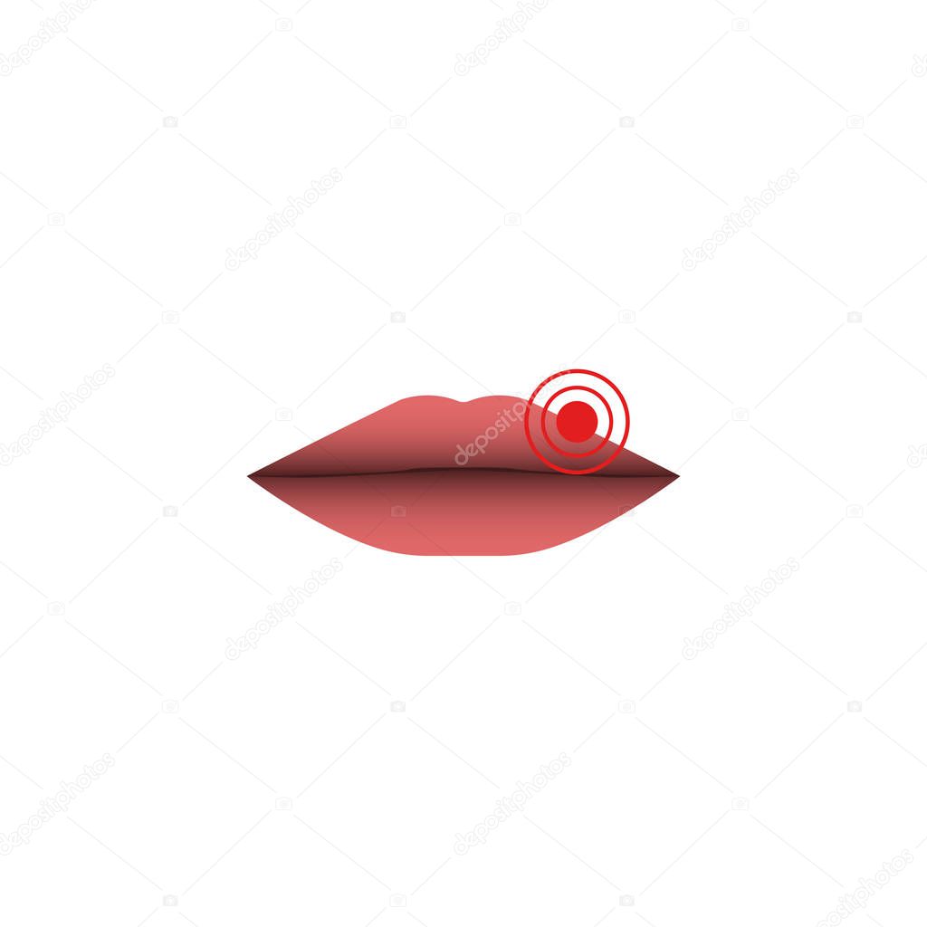 Abstract herpes lips illustration, herpes simplex virus, closeup of female close lips with a target pointing to the HSV-1 source of infection, isolated on white background.