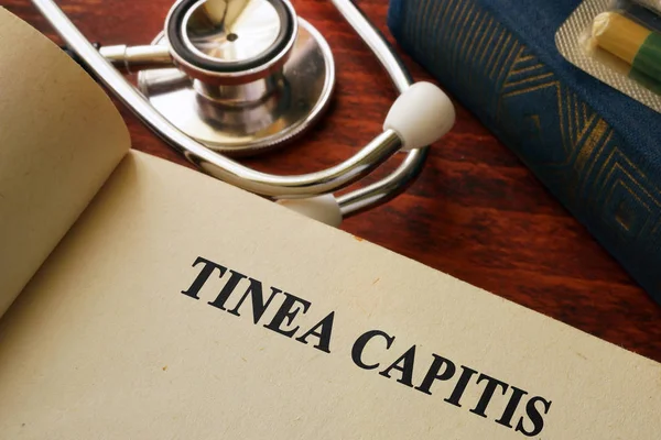 Libro con titolo Tinea capitis. Concetto medico . — Foto Stock