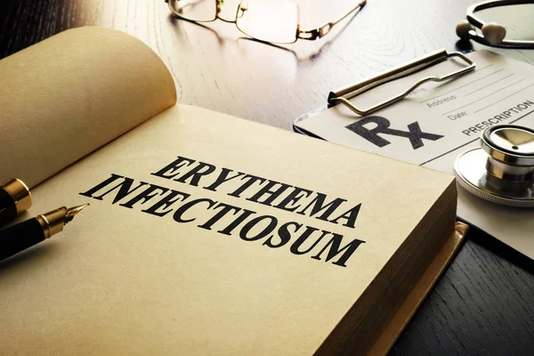 Buku tentang Erythema infectiosum atau penyakit kelima . — Stok Foto