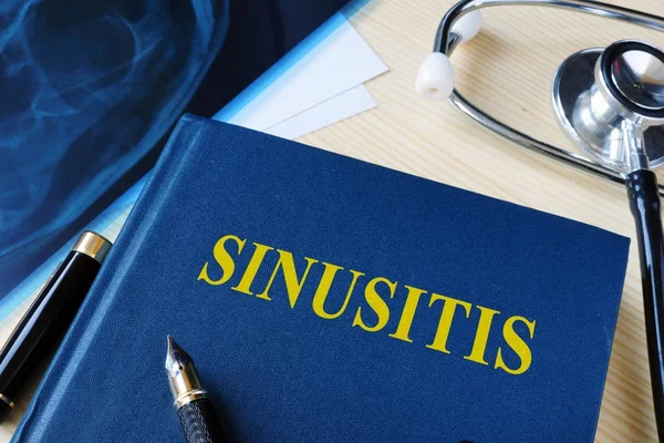 Buku tentang sinusitis di meja rumah sakit . — Stok Foto