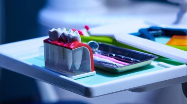 Diş şapkalı bu modeli gösterir ve diş etleri Paslanmaz pin.