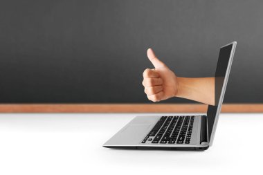 Dizüstü alüminyum gövde