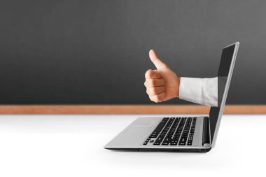 Dizüstü alüminyum gövde