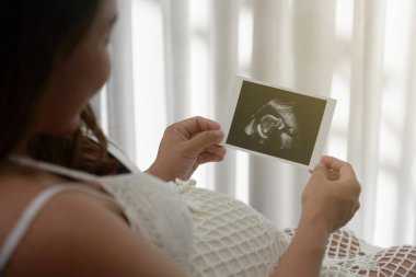 pregnant woman looking at ultrasound scan of baby clipart