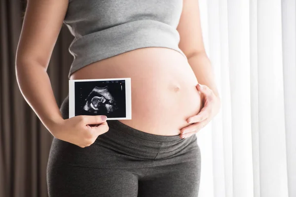 Pregnant woman touching her belly with ultrasound scan — Stock Photo, Image