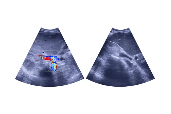 Ultrason Üst Karın Göstergesi Karaciğer Safra Kesesi Beyaz Arka Planda — Stok fotoğraf