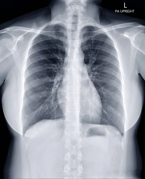 33 Cxr Stock Photos Images Download Cxr Pictures On Depositphotos 33 Cxr Stock Photos Images Download Cxr Pictures On Depositphotos