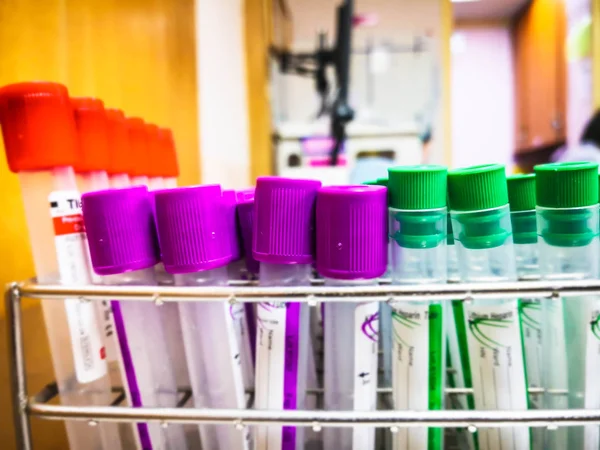 Colorful Background Rack Color Tubes Blood Samples Other Patients Laboratory — Stock Photo, Image