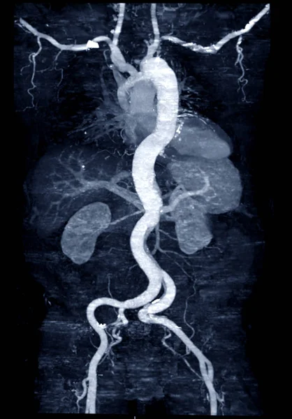 Close Van Scanner Met Rode Laserstraal Voor Het Instellen Van — Stockfoto