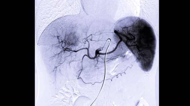 Siyah Karaciğer Görüntüsü — Stok video