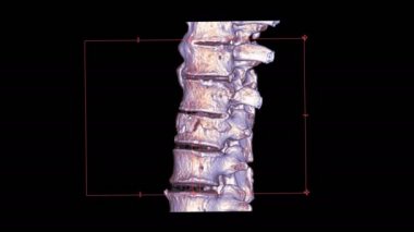 Siyah üzerine izole edilmiş Cta 3d omurga görüntüsü