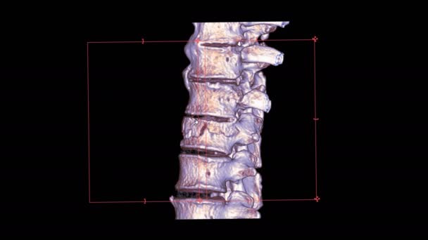 黒に隔離された脊椎のCta 3Dレンダリングの映像 — ストック動画