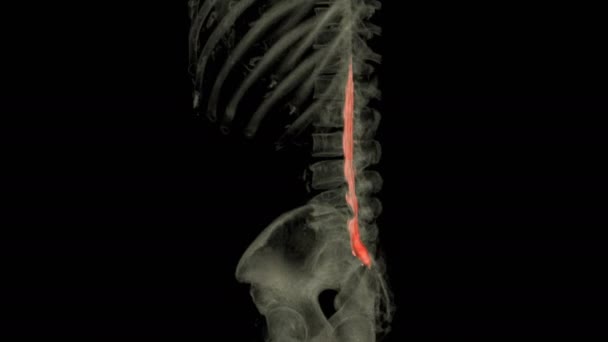 Resonancia Magnética Del Mielograma Técnica Uso Columna Cervical Plano Coronal — Vídeos de Stock