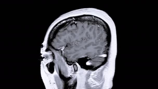 Imagini Creierul Rmn Izolat Negru — Videoclip de stoc