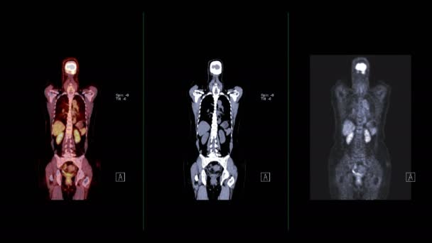 Bilder Från Pet Compare Cor Isolerad Svart — Stockvideo