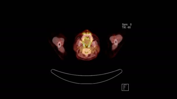 Tomografía Computarizada Pet Escaneo Todo Cuerpo Cabeza Los Pies Con — Vídeo de stock