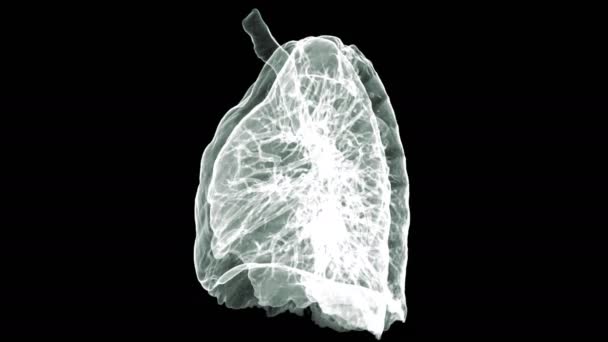 Lung Renderelés Kép Forog Képernyőn Diagnosztikai Tüdőrák — Stock videók