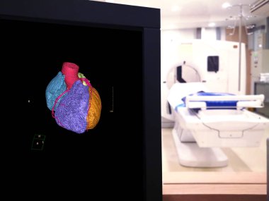 Cta koroner arter 3 boyutlu görüntüyü hastanedeki tomografi odasındaki mornitor üzerinde gösteriyor..
