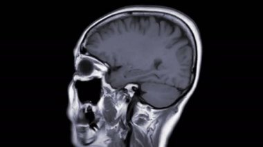 Siyah üzerine izole edilmiş beyin MR 'ının görüntüleri 