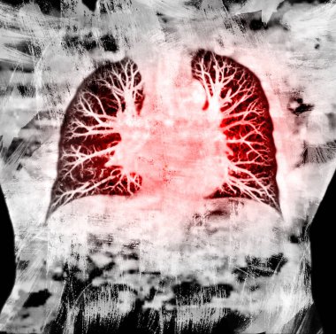 Fırça boyama tekniği Lung 3D görüntü görüntüleme arkaplanı covid-19. Dijital resim.