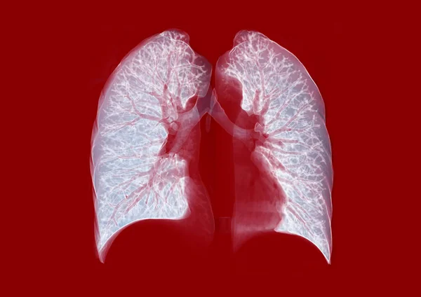 Mellkas Vagy Tüdő Renderelés Kép Piros Háttér Diagnózis Tuberkulózis Covid — Stock Fotó