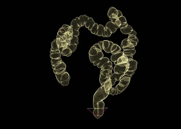结肠三维显像的Ct或Ct扫描 显示结肠的黄色美联社图像 以筛选结肠癌 检查结肠癌检查结果 — 图库照片