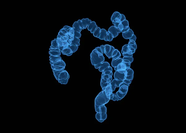结肠3D显像的Ct或Ct扫描 显示结肠的蓝色Ap图像 用于结直肠癌的筛查 检查结肠癌检查结果 — 图库照片