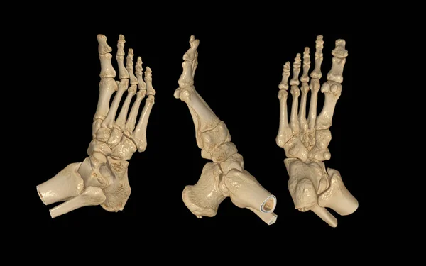 Scan Right Foot Rendering Image Lateral Bottom View Medical Technology — Fotografia de Stock