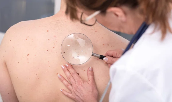 Dermatologista examinando a pele de um paciente — Fotografia de Stock