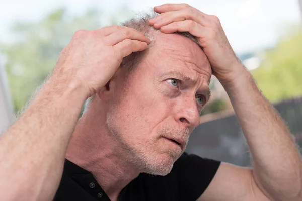 髪の心配の年配の男性 — ストック写真