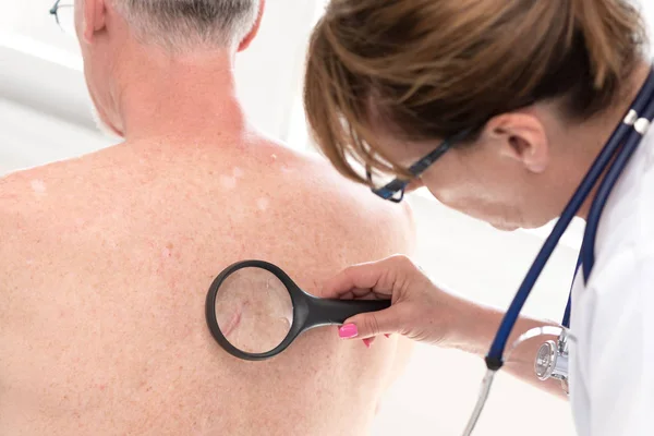 Dermatólogo examinando la piel de un paciente — Foto de Stock