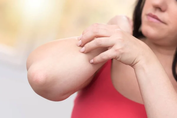 Vrouw met jeuk en krabben van haar arm, licht effect — Stockfoto