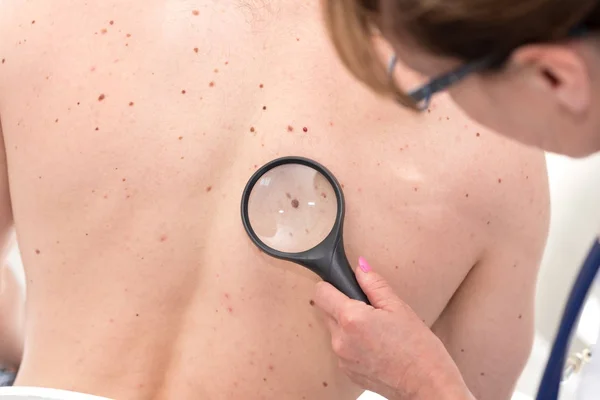 Dermatologista examinando a pele de um paciente — Fotografia de Stock