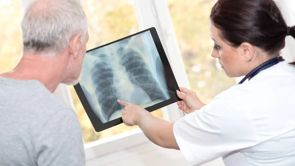 Doktor ukazující rentgenová zpráva k pacientovi — Stock fotografie