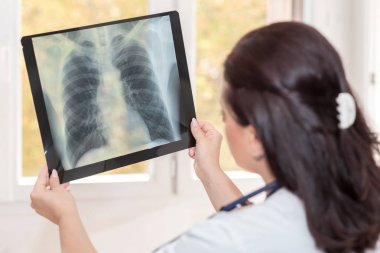 Doktor Röntgen rapor incelenmesi